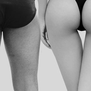 VELASHAPE MUSLO POSTERIOR VELASHAPE MUSLO POSTERIOR