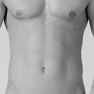 VELASHAPE ABDOMEN